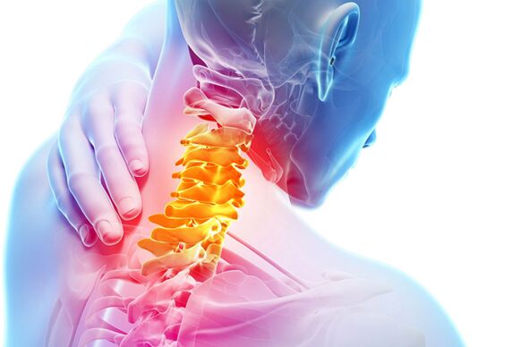 шейный остеохондроз